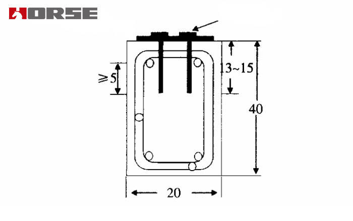 "Fibre bundle anchor" anchoring method